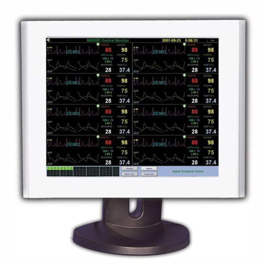 Patient Monitoring S